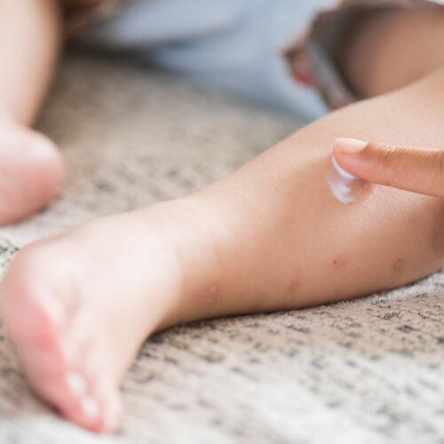 Avena coloidal para tu bebé: cuidado de la piel sensible