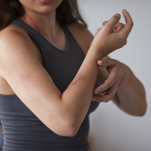 Cómo calmar la piel irritada: alivio para el picor